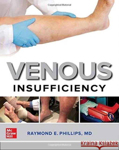 Venous Insufficiency Raymond E. Phillips 9781260461268 McGraw-Hill Education / Medical - książka