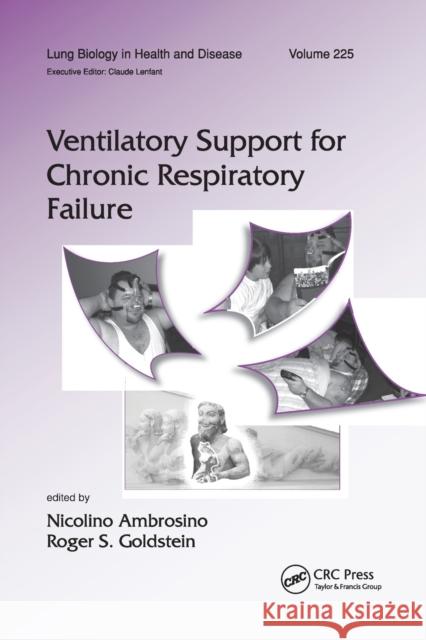 Ventilatory Support for Chronic Respiratory Failure Nicolino Ambrosino Roger S. Goldstein 9780367387686 CRC Press - książka