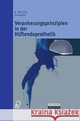 Verankerungsprinzipien in Der Hüftendoprothetik Wetzel, Roland 9783642633195 Steinkopff-Verlag Darmstadt - książka