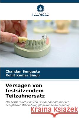 Versagen von festsitzendem Teilzahnersatz Chandan SenGupta Rohit Kumar Singh 9786207552030 Verlag Unser Wissen - książka