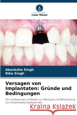 Versagen von Implantaten: Gründe und Bedingungen Singh, Akanksha, Singh, Rika 9786207027903 Verlag Unser Wissen - książka