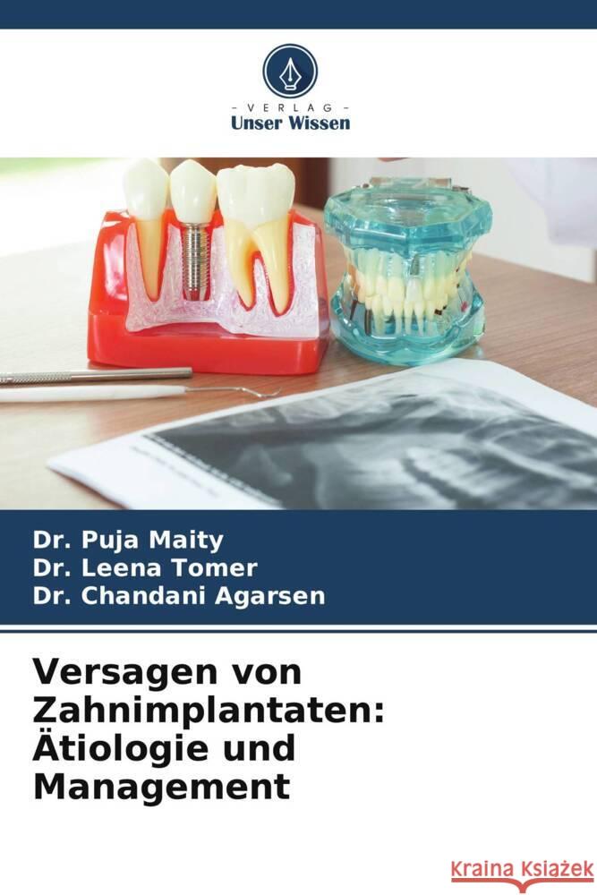 Versagen von Zahnimplantaten: Ätiologie und Management Maity, Dr. Puja, Tomer, Dr. Leena, Agarsen, Dr. Chandani 9786206369165 Verlag Unser Wissen - książka