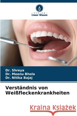 Verständnis von Weißfleckenkrankheiten ,, Dr. Shreya, Bhola ,, Dr. Meenu, Bajaj, Dr. Nitika 9786209012952 Verlag Unser Wissen - książka