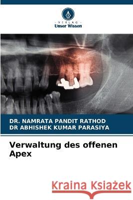 Verwaltung des offenen Apex Dr Namrata Pandit Rathod Dr Abhishek Kumar Parasiya  9786206095194 Verlag Unser Wissen - książka