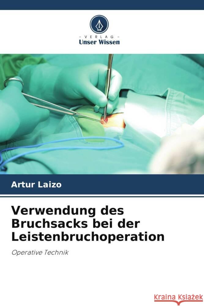 Verwendung des Bruchsacks bei der Leistenbruchoperation Artur Laizo 9786207217748 Verlag Unser Wissen - książka