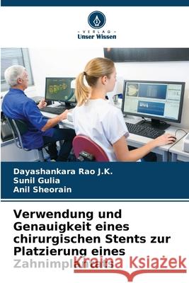 Verwendung und Genauigkeit eines chirurgischen Stents zur Platzierung eines Zahnimplantats Rao J.K., Dayashankara, Gulia, Sunil, Sheorain, Anil 9786208687496 Verlag Unser Wissen - książka