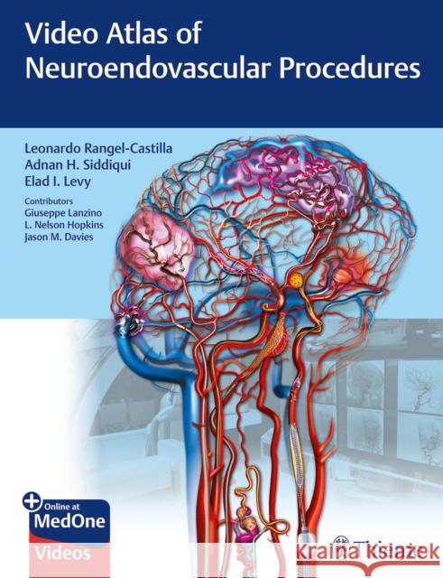 Video Atlas of Neuroendovascular Procedures Leonardo Rangel-Castilla Adnan Siddiqui Elad Levy 9781684201181 Thieme Medical Publishers - książka