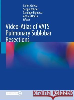 Video-Atlas of VATS Pulmonary Sublobar Resections Carlos Galvez Sergio Bolufer Santiago Figueroa 9783031144547 Springer - książka