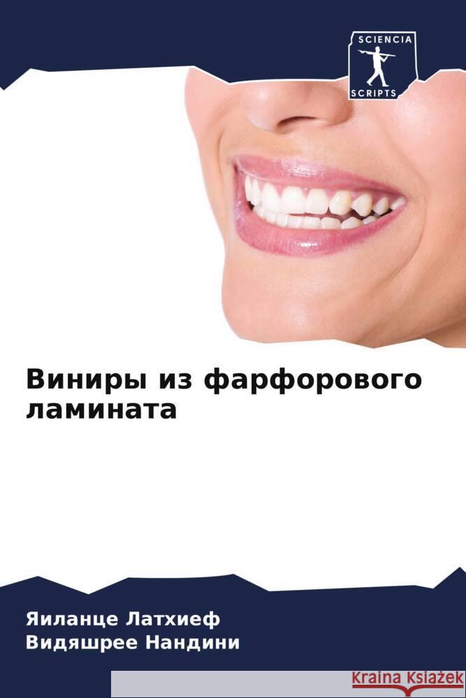 Viniry iz farforowogo laminata Lathief, Yailance, Nandini, Vidqshree 9786206938309 Sciencia Scripts - książka