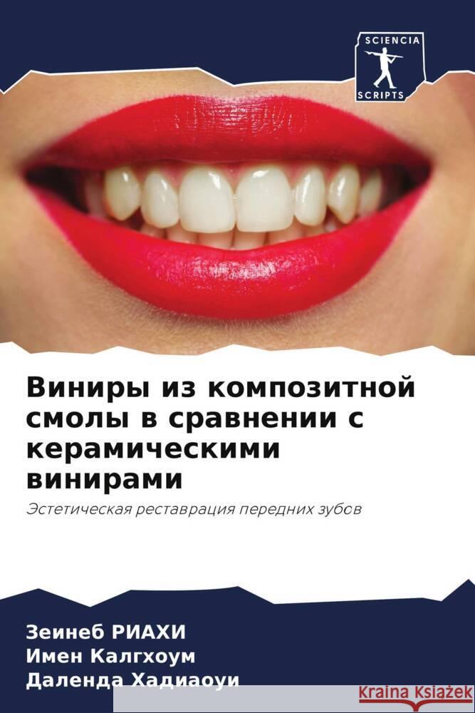 Viniry iz kompozitnoj smoly w srawnenii s keramicheskimi winirami Riahi, Zeineb, Kalghoum, Imen, Hadiaoui, Dalenda 9786208587994 Sciencia Scripts - książka