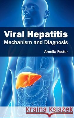 Viral Hepatitis: Mechanism and Diagnosis Amelia Foster 9781632424235 Foster Academics - książka