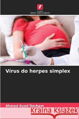 Virus do herpes simplex Ahmad Ayed Derham   9786205647349 Edicoes Nosso Conhecimento - książka