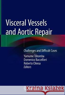 Visceral Vessels and Aortic Repair: Challenges and Difficult Cases Tshomba, Yamume 9783319947600 Springer - książka
