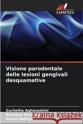 Visione parodontale delle lesioni gengivali desquamative Suchetha Aghanashini Bhavana Puvvalla Sapna Nadiger 9786207586240 Edizioni Sapienza - książka