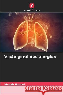 Visão geral das alergias Hamad, Mosab 9786205297353 Edicoes Nosso Conhecimento - książka