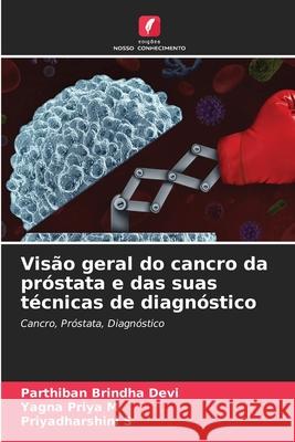 Visão geral do cancro da próstata e das suas técnicas de diagnóstico Brindha Devi, Parthiban, Priya M, Yagna, S, Priyadharshini 9786208855864 Edições Nosso Conhecimento - książka