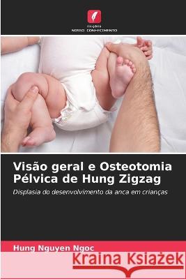 Visão geral e Osteotomia Pélvica de Hung Zigzag Hung Nguyen Ngoc 9786205353271 Edicoes Nosso Conhecimento - książka