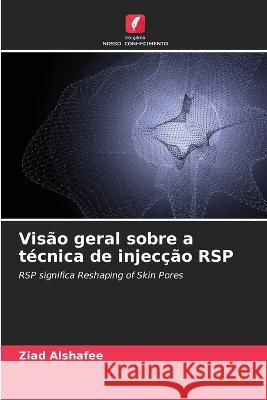 Vis?o geral sobre a t?cnica de injec??o RSP Ziad Alshafee 9786205629109 Edicoes Nosso Conhecimento - książka