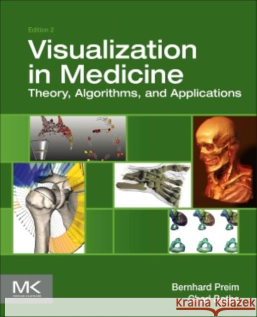Visual Computing for Medicine: Theory, Algorithms, and Applications Preim, Bernhard 9780124158733  - książka