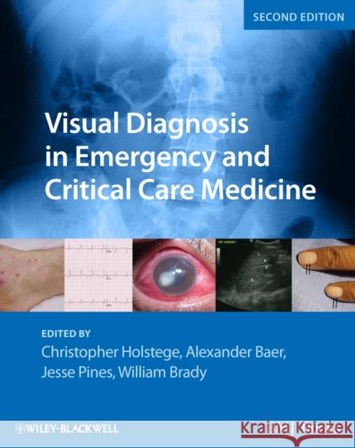 Visual Diagnosis in Emergency and Critical Care Medicine  HOLSTEGE   9781444333473  - książka
