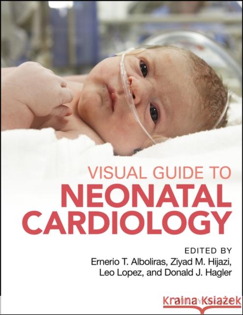 Visual Guide to Neonatal Cardiology Ernerio Alboliras Ziyad Hijazi Cecilio (Leo) Lopez 9781118635148 Wiley-Blackwell - książka