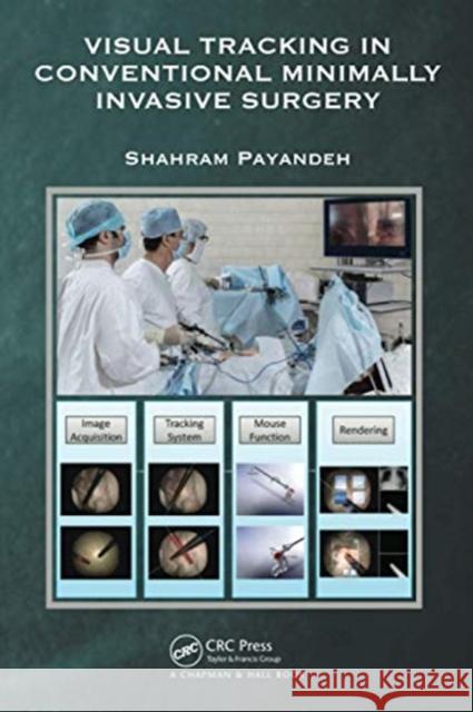 Visual Tracking in Conventional Minimally Invasive Surgery Shahram Payandeh 9780367574307 CRC Press - książka