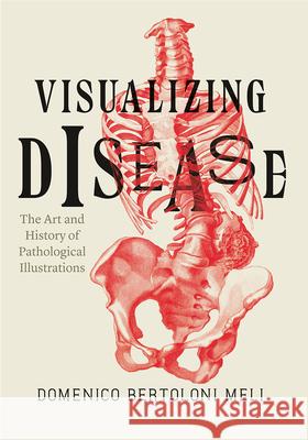 Visualizing Disease: The Art and History of Pathological Illustrations Domenico Bertolon 9780226110295 University of Chicago Press - książka