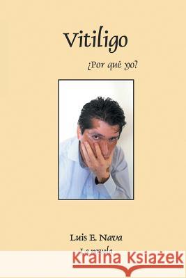 Vitiligo Luis Enrique Nava Martinez 9781463378165 Palibrio - książka