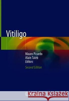 Vitiligo Mauro Picardo Alain Taieb 9783319629582 Springer - książka