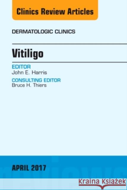 Vitiligo, an Issue of Dermatologic Clinics: Volume 35-2 Harris, John E. 9780323524049 Elsevier - książka