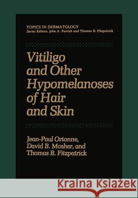 Vitiligo and Other Hypomelanoses of Hair and Skin Jean-Paul Ortonne 9781461592747 Springer - książka