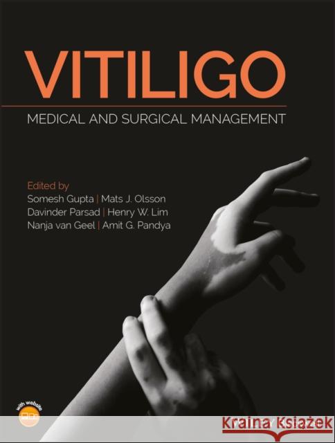 Vitiligo: Medical and Surgical Management Gupta, Somesh 9781118937419 Wiley-Blackwell - książka