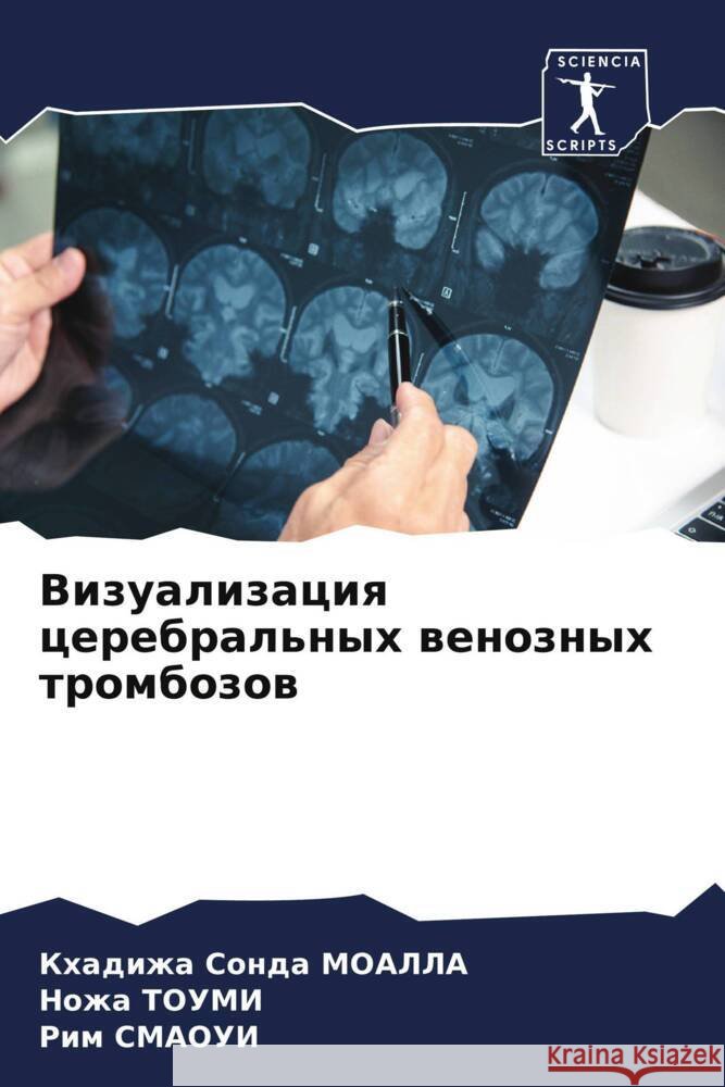 Vizualizaciq cerebral'nyh wenoznyh trombozow MOALLA, Khadizha Sonda, Toumi, Nozha, SMAOUI, Rim 9786208531621 Sciencia Scripts - książka