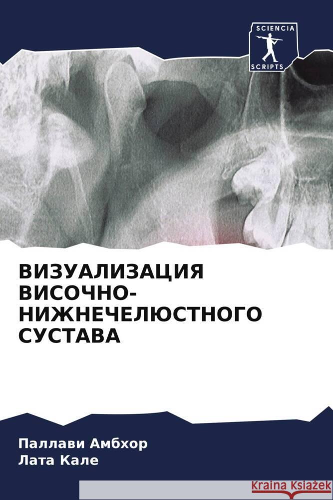 VIZUALIZACIYa VISOChNO-NIZhNEChELJuSTNOGO SUSTAVA Ambhor, Pallawi, Kale, Lata 9786204636641 Sciencia Scripts - książka