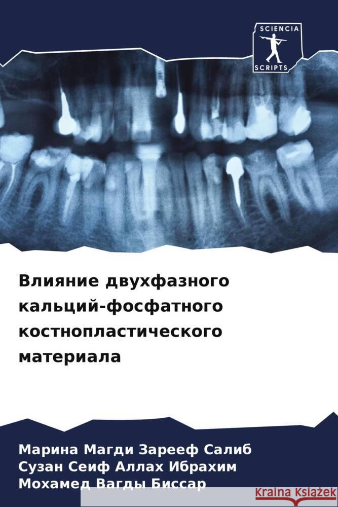 Vliqnie dwuhfaznogo kal'cij-fosfatnogo kostnoplasticheskogo materiala Magdi Zareef Salib, Marina, Seif Allah Ibrahim, Suzan, Vagdy Bissar, Mohamed 9786205440667 Sciencia Scripts - książka