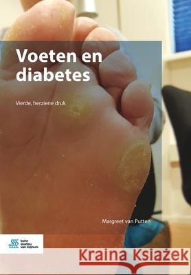 Voeten En Diabetes Van Putten, Margreet 9789036802789 Bohn Stafleu Van Loghum - książka