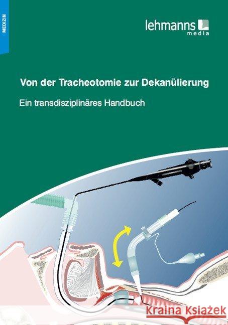 Von der Tracheotomie zur Dekanülierung : Ein transdisziplinäres Handbuch  9783865415127 Lehmanns Media - książka