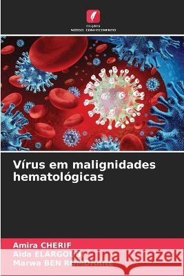 Vírus em malignidades hematológicas Cherif, Amira 9786205249307 Edicoes Nosso Conhecimento - książka