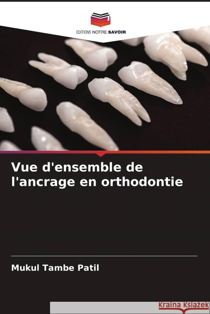 Vue d'ensemble de l'ancrage en orthodontie Tambe Patil, Mukul 9786206497455 Editions Notre Savoir - książka