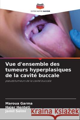Vue d'ensemble des tumeurs hyperplasiques de la cavité buccale Garma, Maroua, Henteti, Hajer, Selmi, Jamil 9786200449542 Editions Notre Savoir - książka