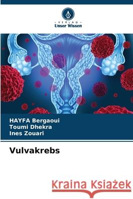 Vulvakrebs Hayfa Bergaoui Toumi Dhekra Ines Zouari 9786207600236 Verlag Unser Wissen - książka