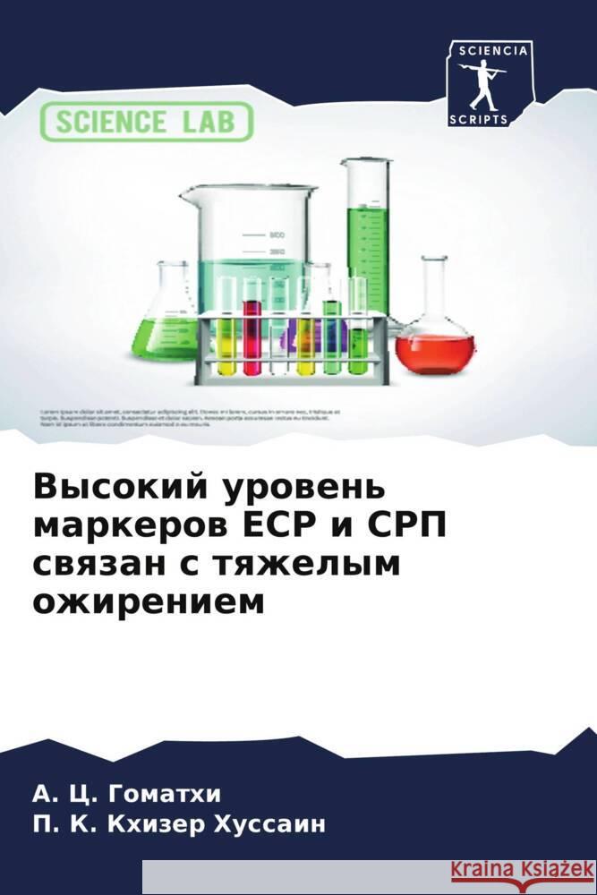 Vysokij urowen' markerow ESR i CRP swqzan s tqzhelym ozhireniem Gomathi, A. C., Hussain, P. K. Khizer 9786204568515 Sciencia Scripts - książka