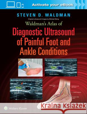 Waldman's Atlas of Diagnostic Ultrasound of Painful Foot and Ankle Conditions Steven Waldman 9781496345462 LWW - książka