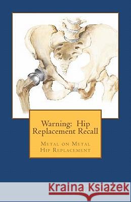 Warning: Hip Replacement Recall: Warning: Hip Replacement Recall Metal on Metal Devices Lisa G. Douglas 9781461042358 Createspace - książka