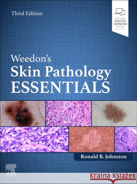 Weedon's Skin Pathology Essentials Ronald Johnston 9780702084478 Elsevier - książka