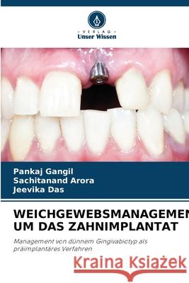 WEICHGEWEBSMANAGEMENT UM DAS ZAHNIMPLANTAT Gangil, Pankaj, Arora, Sachitanand, Das, Jeevika 9786208489090 Verlag Unser Wissen - książka