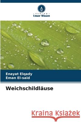 Weichschildl?use Enayat Elqady Eman El-Said 9786207747023 Verlag Unser Wissen - książka