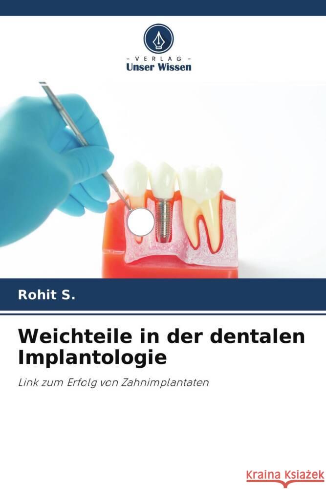 Weichteile in der dentalen Implantologie S., Rohit 9786204237152 Verlag Unser Wissen - książka