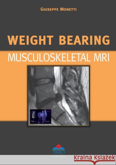Weight Bearing Musculoskeletal MRI G Monetti 9788897162056 Timeo Editore SRL - książka