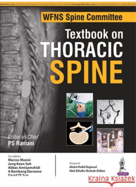 Wfns Spine Committee Textbook on Thoracic Spine Ps Ramani 9789352500079 Jaypee Brothers, Medical Publishers Pvt. Ltd. - książka